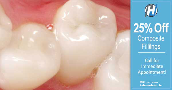 What are Composite Fillings? West Nyack Dentists Explains