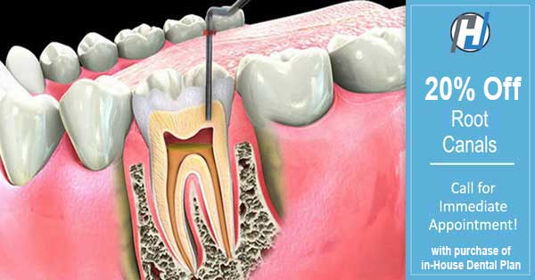 Root Canal Coupon